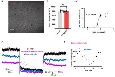 Donepezil as a new therapeutic potential in KCNQ2- and KCNQ3-related autism